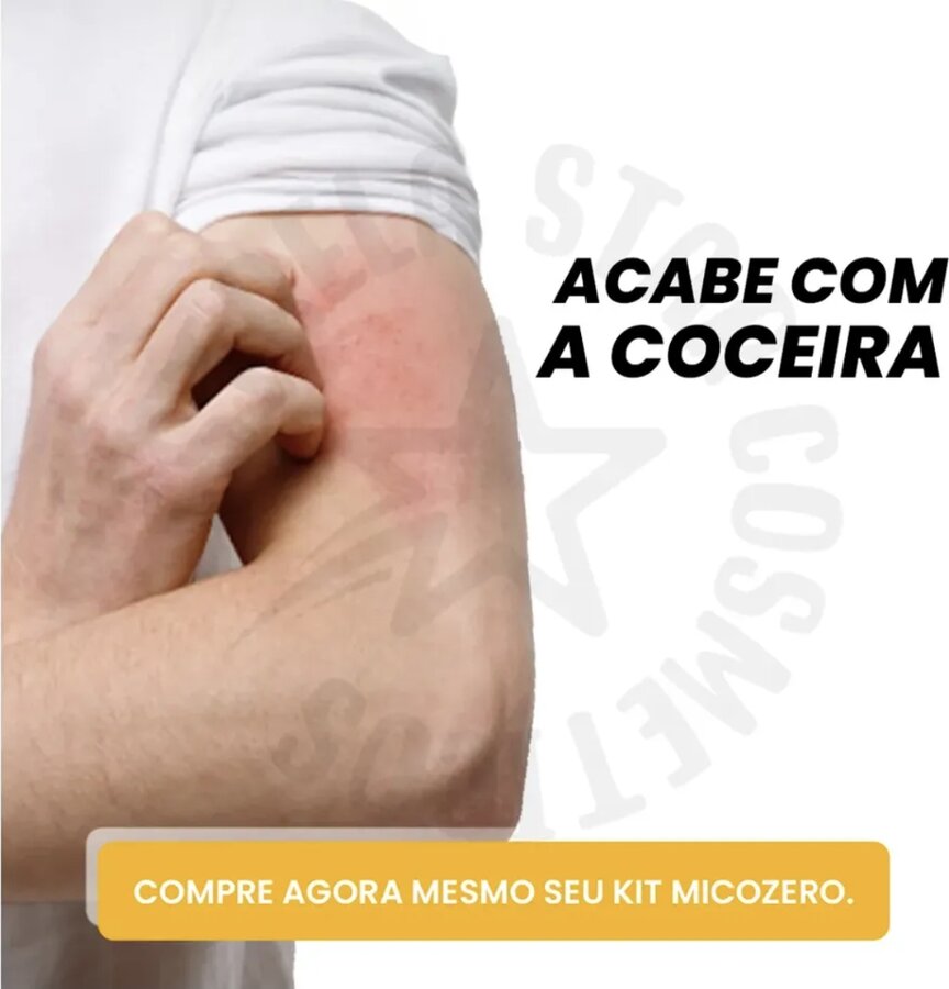 Pomada Micosan para coceira